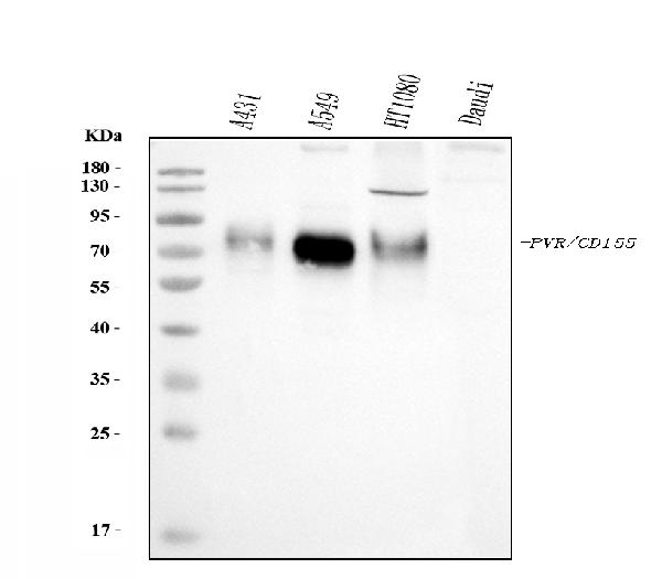 WB - Anti-Poliovirus Receptor/PVR Antibody Picoband™ (monoclonal, 3B11E9) ABO16275
